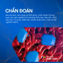 Nhiễm Toxoplasmosis bẩm sinh 6