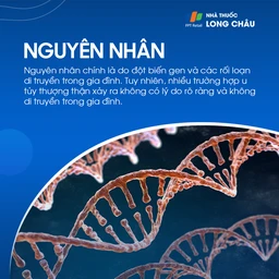 U tủy thượng thận 3