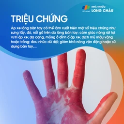 Áp xe lòng bàn tay 2