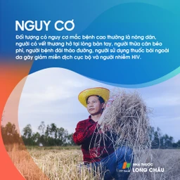 Áp xe lòng bàn tay 4