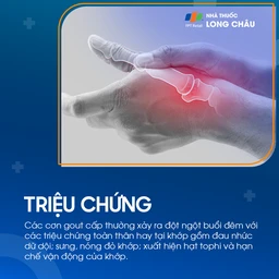 Gout cấp tính 2