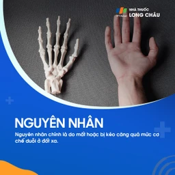 Do rối loạn gân hoặc dây chằng làm mất ổn định cấu trúc ngón tay