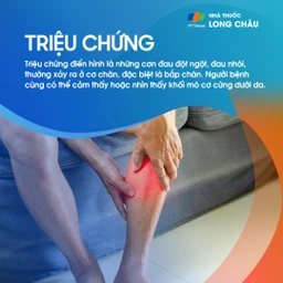 Đau nhói bất ngờ ở bắp chân, sờ thấy khối cơ cứng dưới da