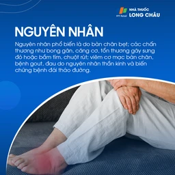 Nguyên nhân đau chân: Đau chân có thể do bàn chân bẹt, bong gân, chuột rút, viêm cơ, bệnh gout, thần kinh hoặc biến chứng tiểu đường