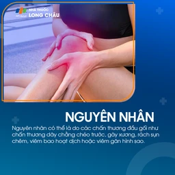 Đau đầu gối có thể bắt nguồn từ chấn thương dây chằng, gãy xương, rách sụn chêm hoặc viêm bao hoạt dịch
