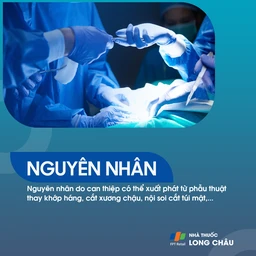 Đau đùi dị cảm 4