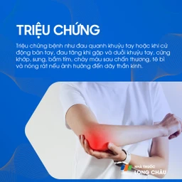 Triệu chứng đau khớp khuỷu tay: Người bệnh cảm thấy đau khi cử động khuỷu tay