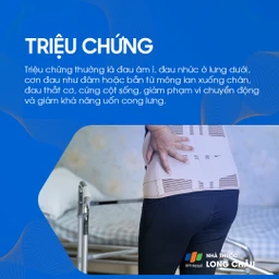 Các triệu chứng của đau lưng rất đa dạng, từ đau âm ỉ, đau nhói lan xuống chân cho đến cứng cột sống và giảm khả năng vận động