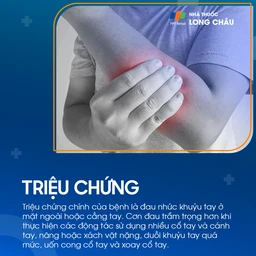 Hội chứng đường hầm xương quay 2