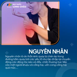 Hội chứng đường hầm xương quay 3