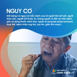 Huyết khối tĩnh mạch sâu 5