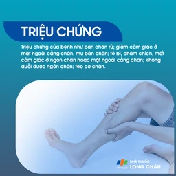Liệt dây thần kinh hông khoeo ngoài 2