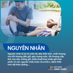 Liệt dây thần kinh hông khoeo ngoài 3