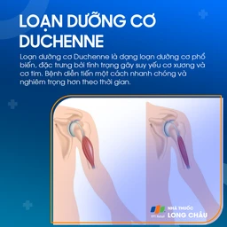 Loạn dưỡng cơ Duchenne 1