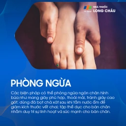 Ngón chân hình búa 8