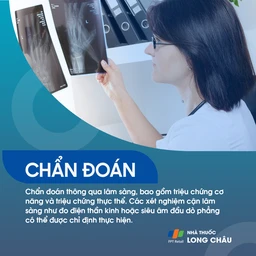 Hội chứng ống cổ tay 6