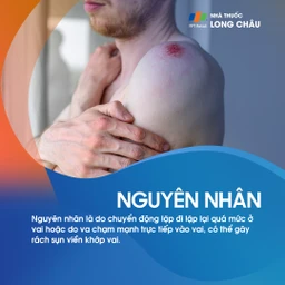 Rách sụn viền khớp vai 3