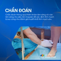 Suy giãn tĩnh mạch chi dưới 6
