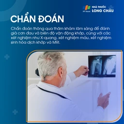 Thoái hóa khớp vai 6