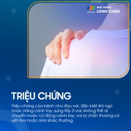Trật khớp cùng đòn 2