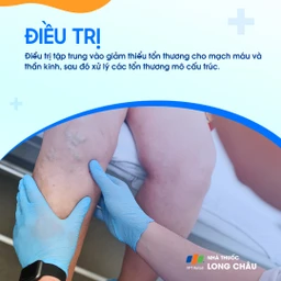 Trật khớp gối 7