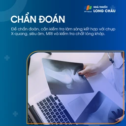 Viêm bao hoạt dịch khớp gối 5