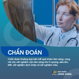 Bác sĩ chẩn đoán viêm bao hoạt dịch khớp vai qua phim X-quang