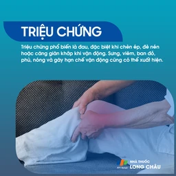 Viêm bao hoạt dịch 2