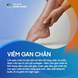 Viêm cân gan chân 1