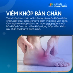 Viêm khớp bàn chân 1