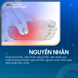 Viêm khớp bàn chân 4