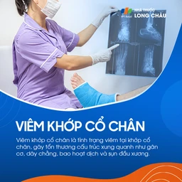 Viêm khớp cổ chân 1