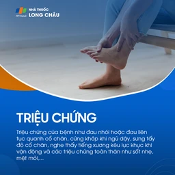 Viêm khớp cổ chân 2