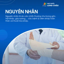 Viêm khớp cổ chân 3