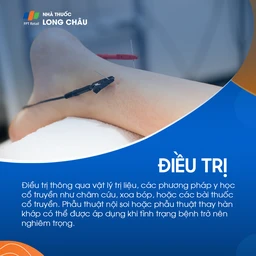 Viêm khớp cổ chân 6