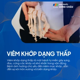 Viêm khớp dạng thấp 1