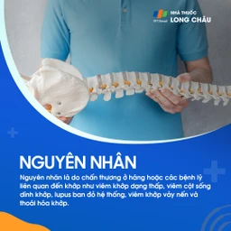 Viêm khớp háng 3