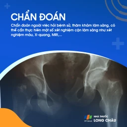 Viêm khớp háng 5