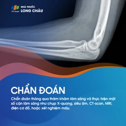 Viêm khớp khuỷu tay 5