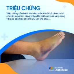 Viêm khớp mắt cá chân 3