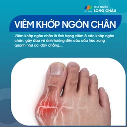 Viêm khớp ngón chân 1