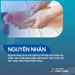 Viêm khớp ngón chân 3