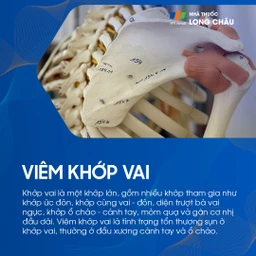 Viêm khớp vai 1