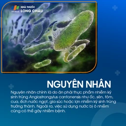 Nhiễm bệnh Angiostrongyliasis 3