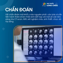 U não nguyên phát 5