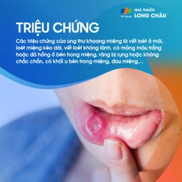 Ung thư khoang miệng 2