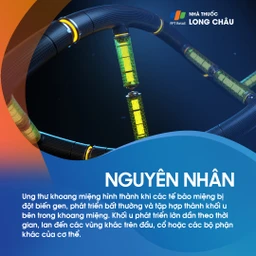 Ung thư khoang miệng 3