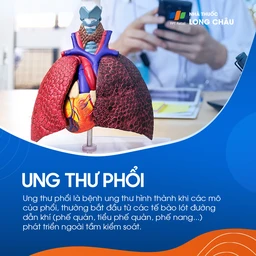 Ung thư phổi 1