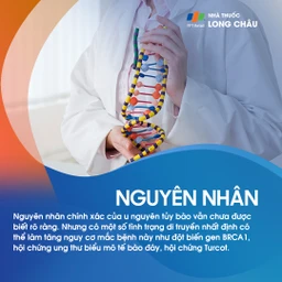 U nguyên tủy bào 3