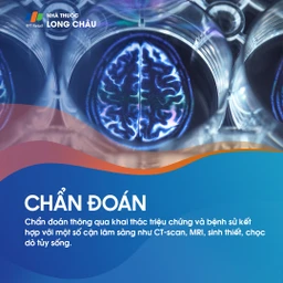 U nguyên tủy bào 5